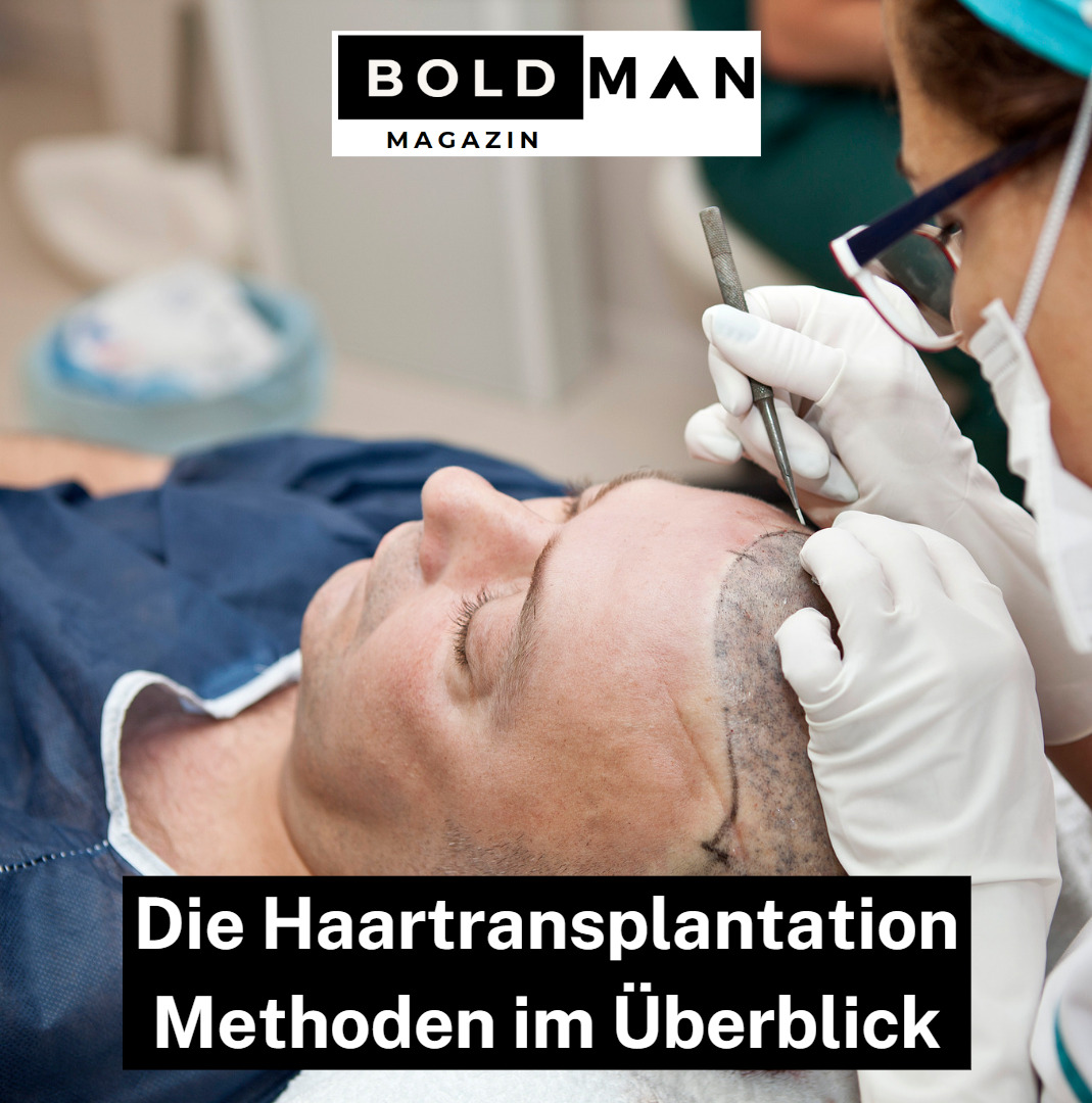 Die Haartransplantation Methoden im Überblick