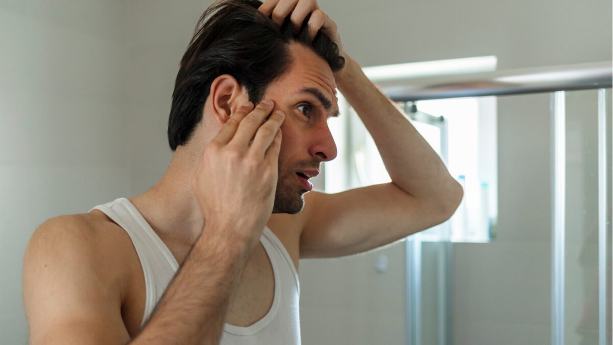 Was tun gegen Geheimratsecken bei Männern? Tipps und Tricks gegen Haarausfall