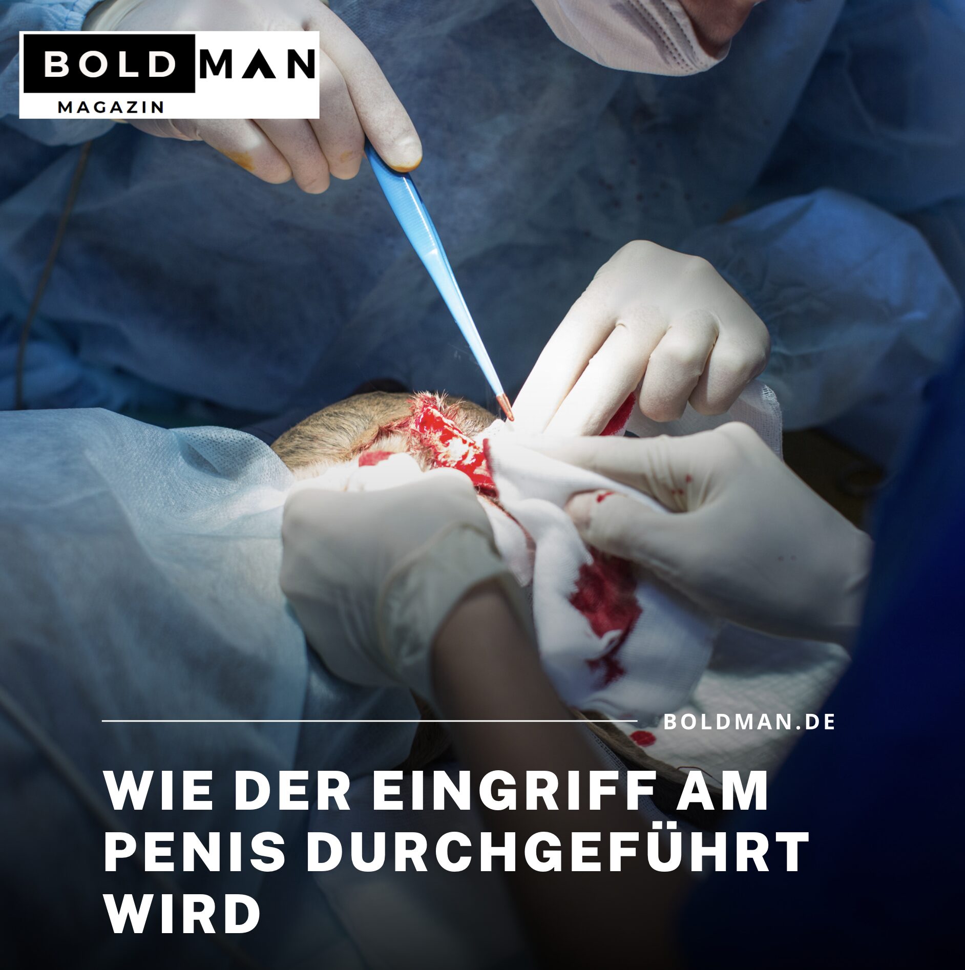 Beschnittener Penis - Eingriff Beschnittener Penis - Eingriff