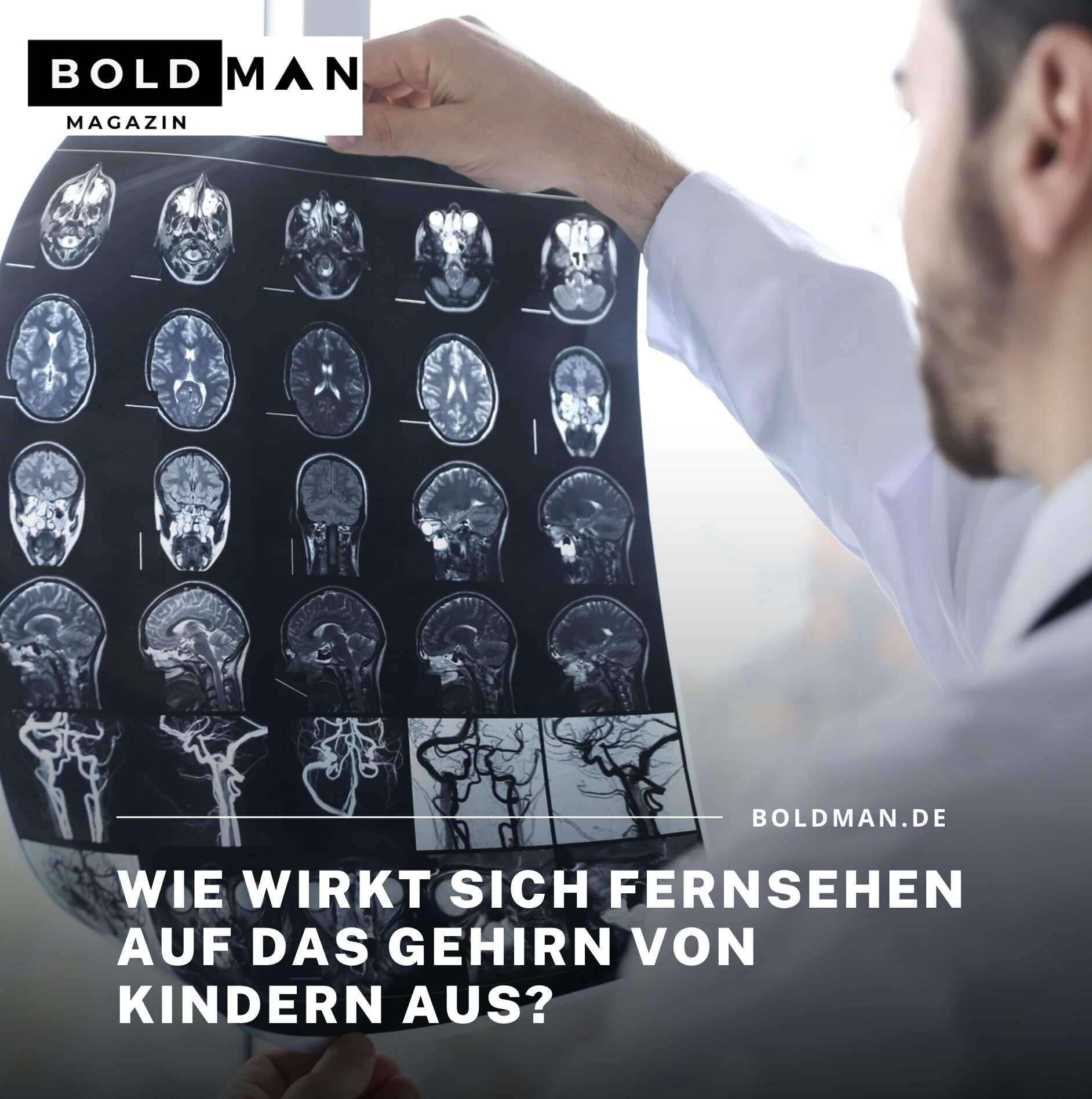 Wie wirkt sich Fernsehen auf das Gehirn von Kindern aus? Wie wirkt sich Fernsehen auf das Gehirn von Kindern aus?